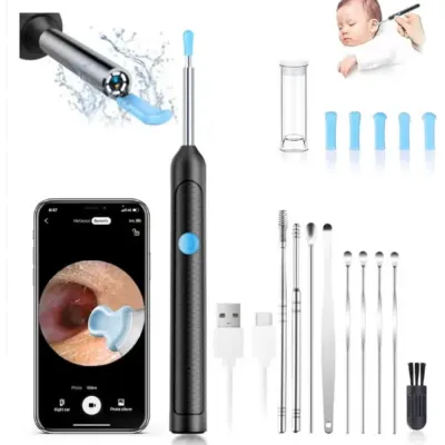 Ear Wax Removal - 2000w HD camera